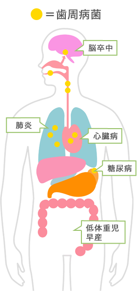 歯周病の全身への影響